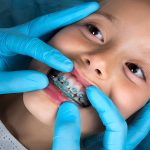 The Importance of Early Orthodontic Care in Children’s Smile Development