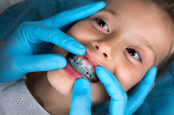 The Importance of Early Orthodontic Care in Children’s Smile Development