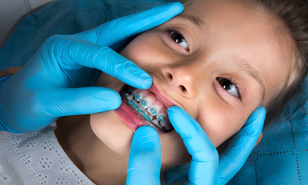 The Importance of Early Orthodontic Care in Children’s Smile Development