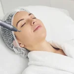 Exploring Advanced Laser Treatments for Skin Resurfacing and Rejuvenation
