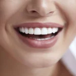 5 Small Smile Enhancements That Photograph Better Than Whitening Alone