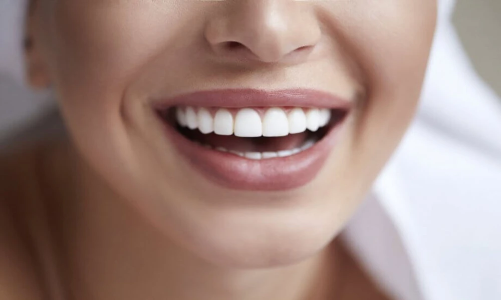 5 Small Smile Enhancements That Photograph Better Than Whitening Alone