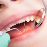 Why Repeated Vomiting Can Leave Distinct Patterns On A Child’s Teeth
