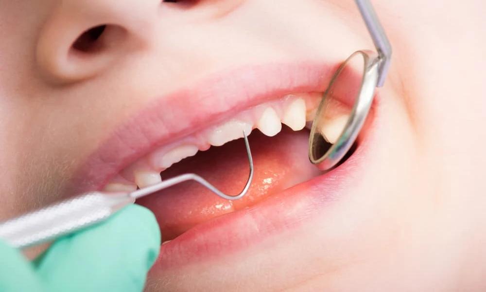 Why Repeated Vomiting Can Leave Distinct Patterns On A Child’s Teeth
