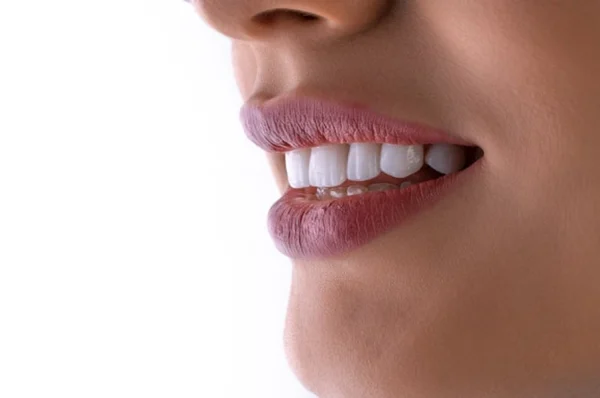 Carbamide Peroxide Vs. Hydrogen Peroxide In Dentist Supervised Teeth Whitening