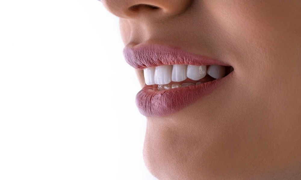 Carbamide Peroxide Vs. Hydrogen Peroxide In Dentist Supervised Teeth Whitening